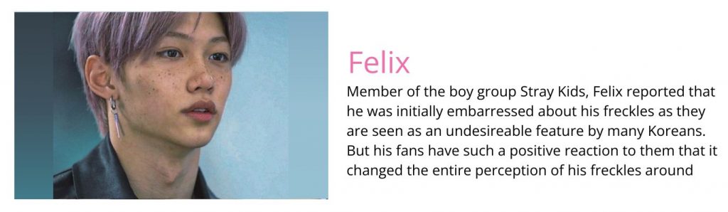 Felix_Kpop plastic surgery
