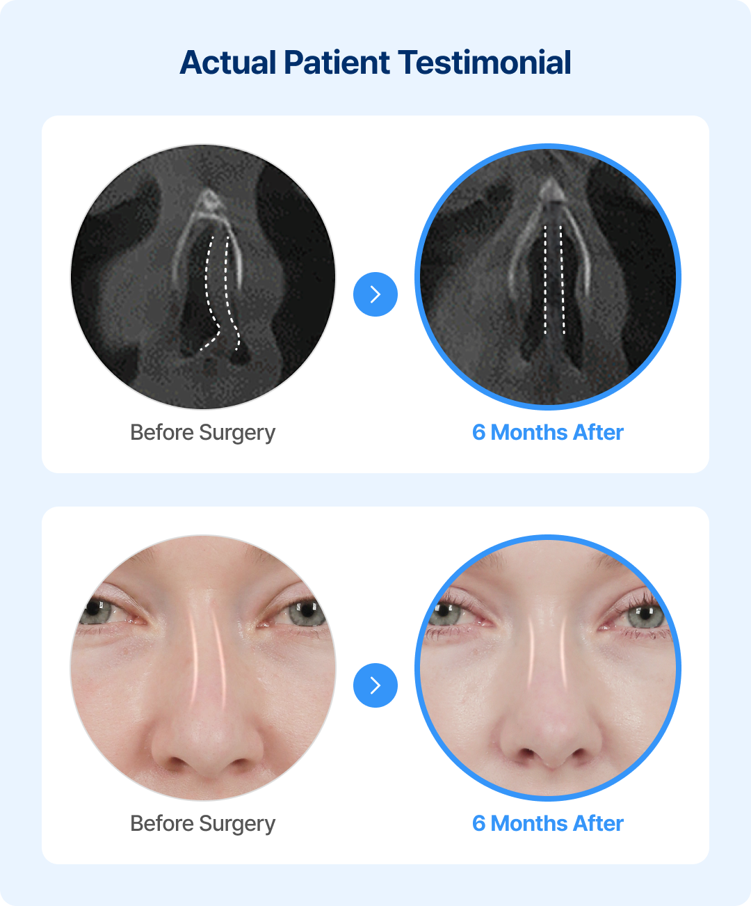 Actual Patient Testimonial