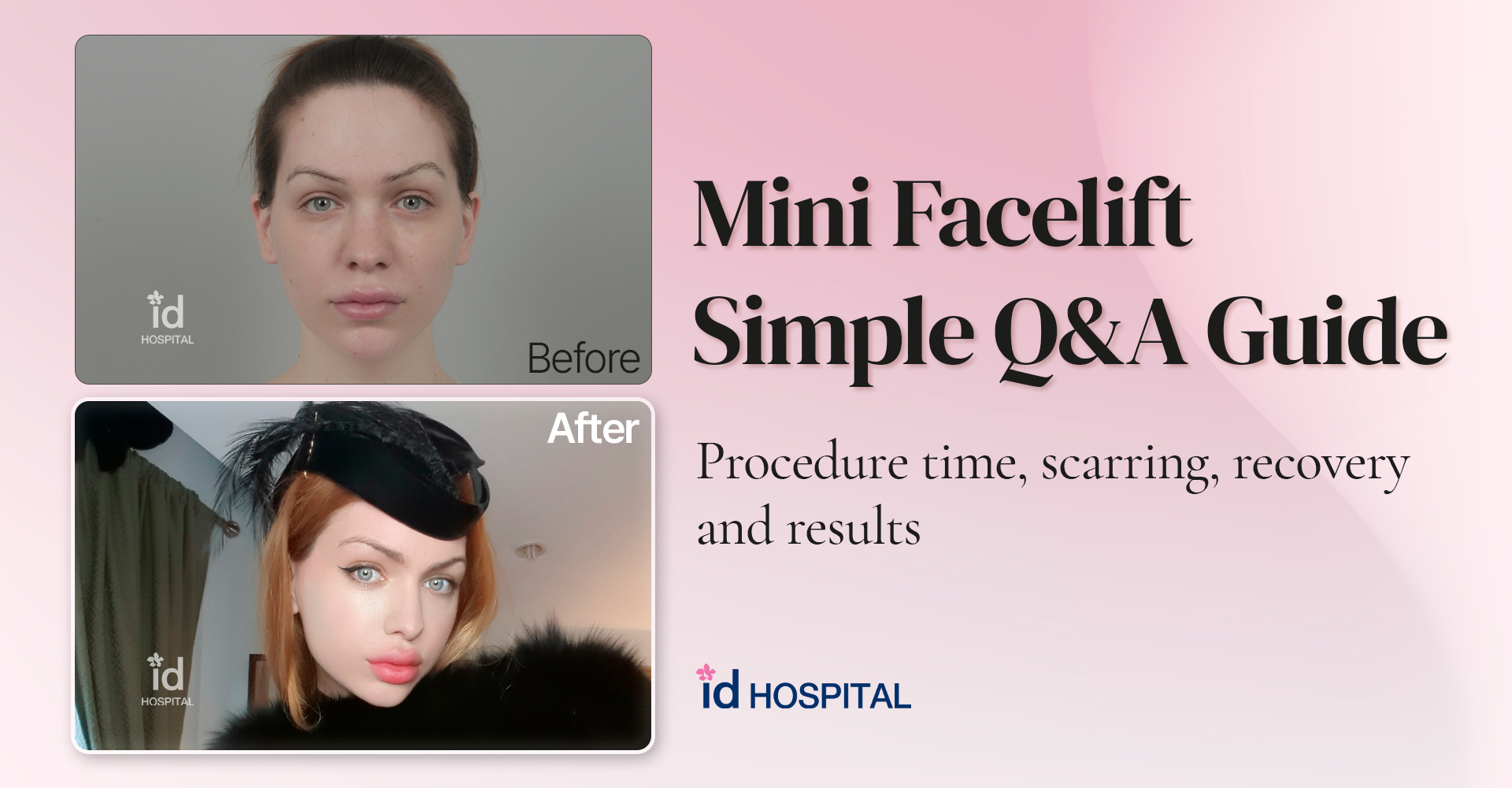 What Exactly Is a Mini Facelift? A Simple Guide with Q&A for Beginners