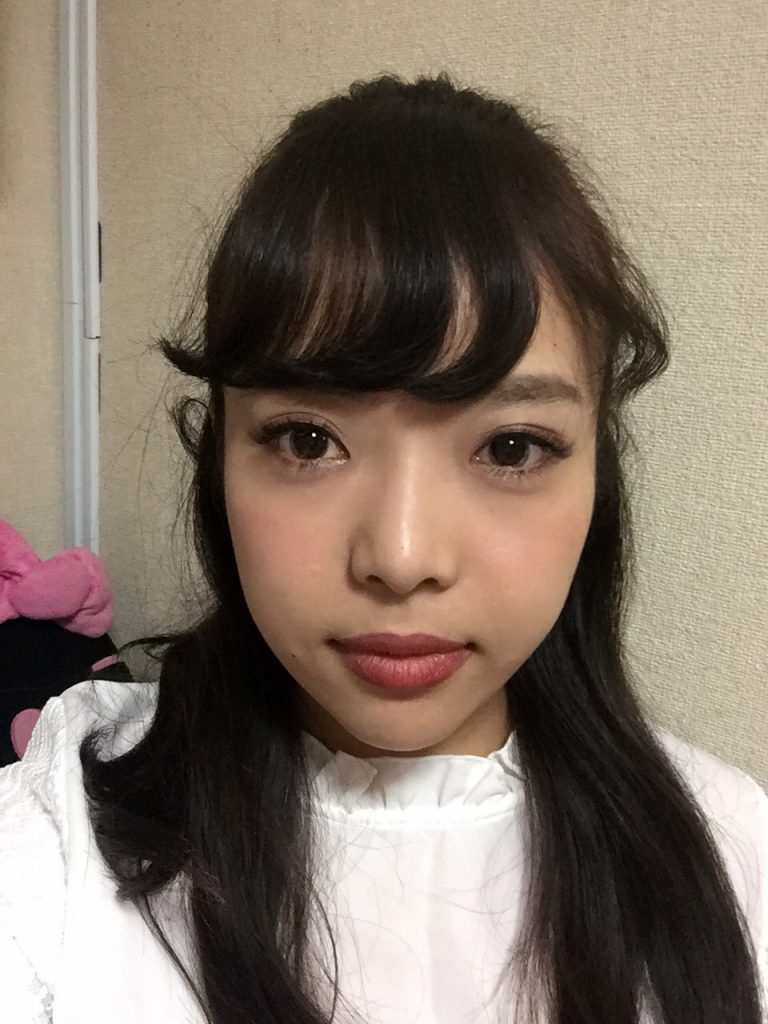 Naoko Facial bone surgeries