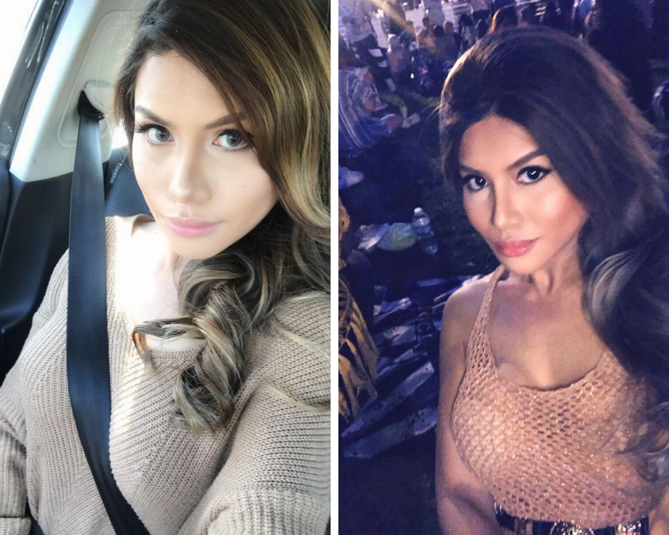 facial feminization surgeries in Korea