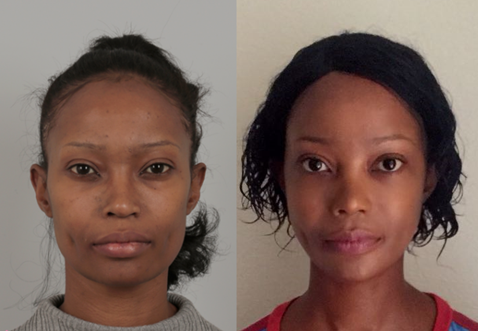 total makeover surgeries